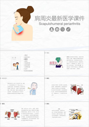肩周炎最新医学综合知识大全课件